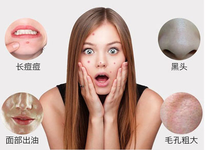 抗菌洗臉?biāo)⒚? 肌膚清潔刻不容緩
